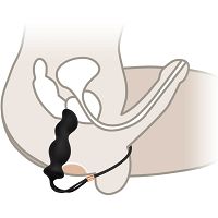 Korek analny z pętlą anal plug do pieszczot prostaty z zaciskiem na jądra i penisa - 73559087 - 3